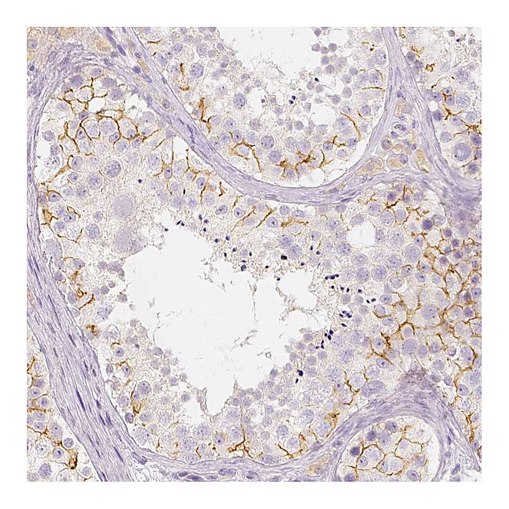 Atlas Antibodies Anti-BATF Antibody