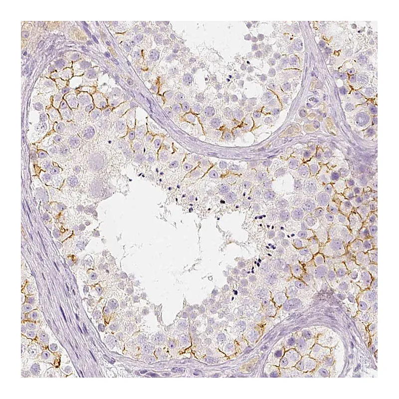 Atlas Antibodies Anti-BATF Antibody