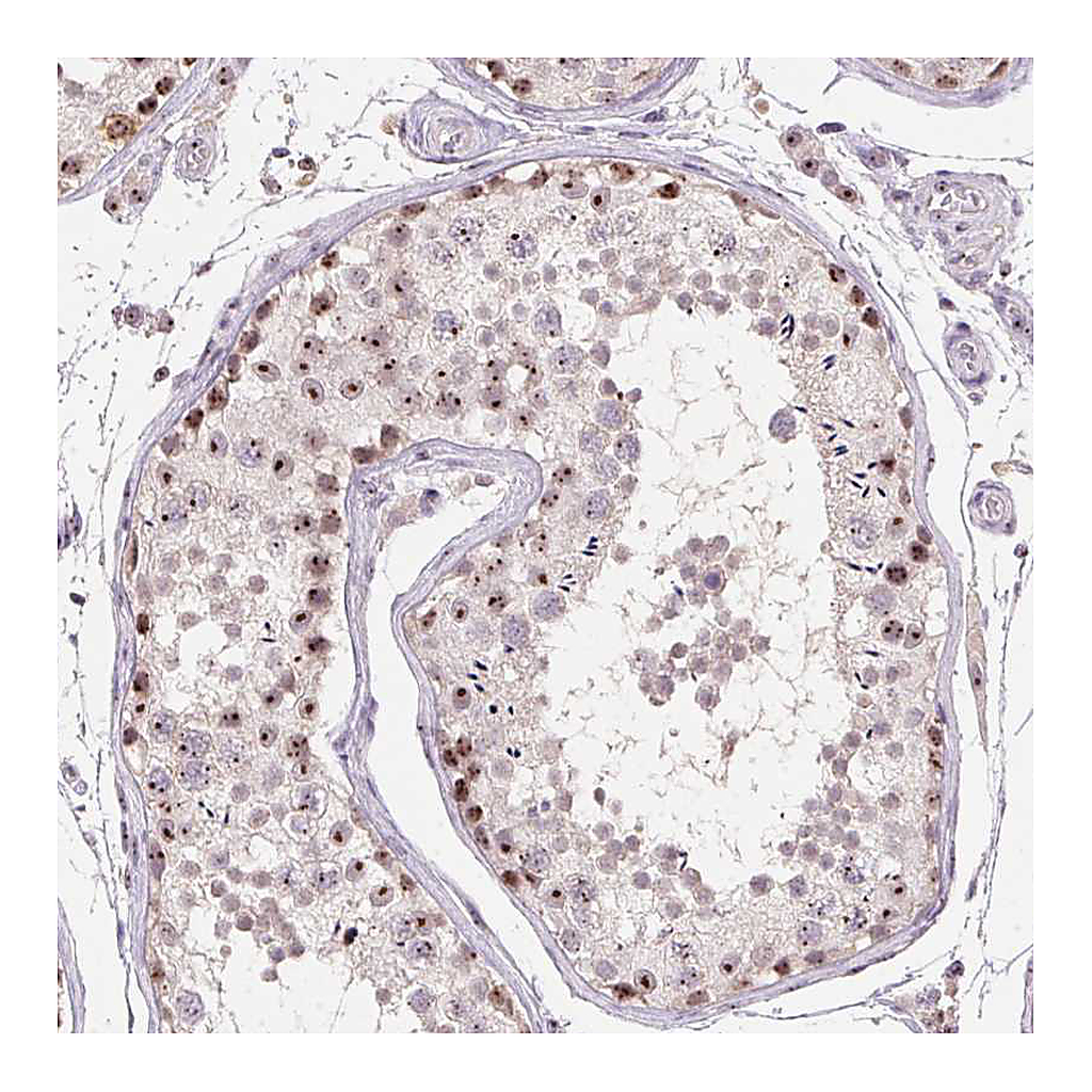 Atlas Antibodies Anti-BATF2 Antibody