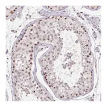 Atlas Antibodies Anti-BATF2 Antibody