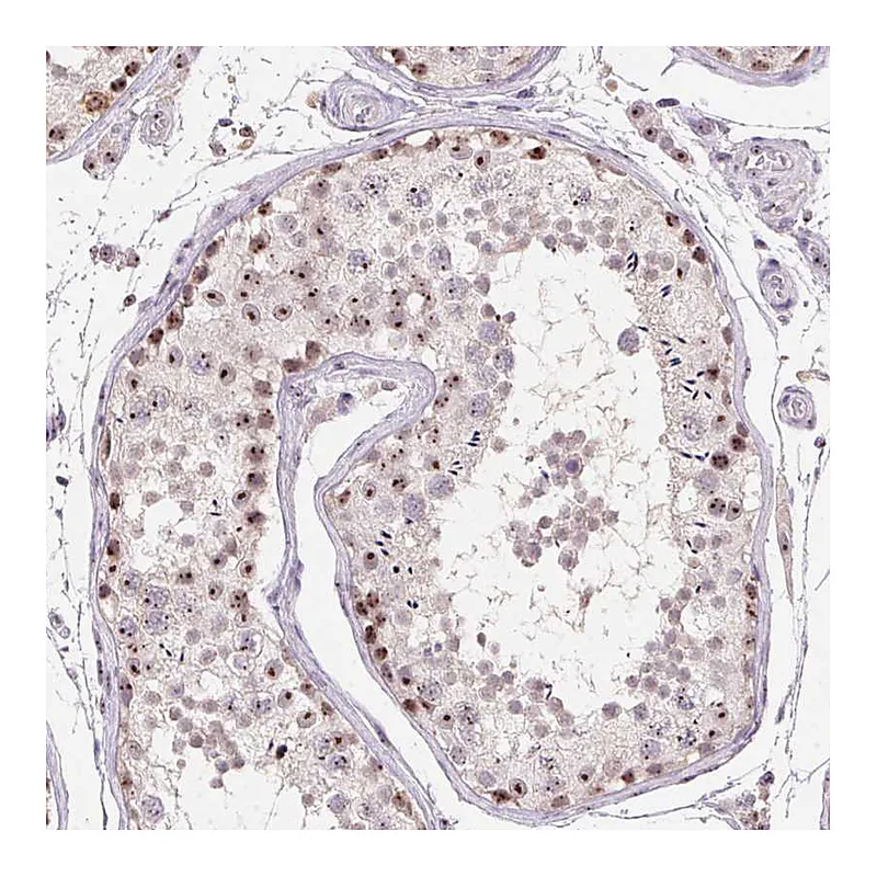 Atlas Antibodies Anti-BATF2 Antibody