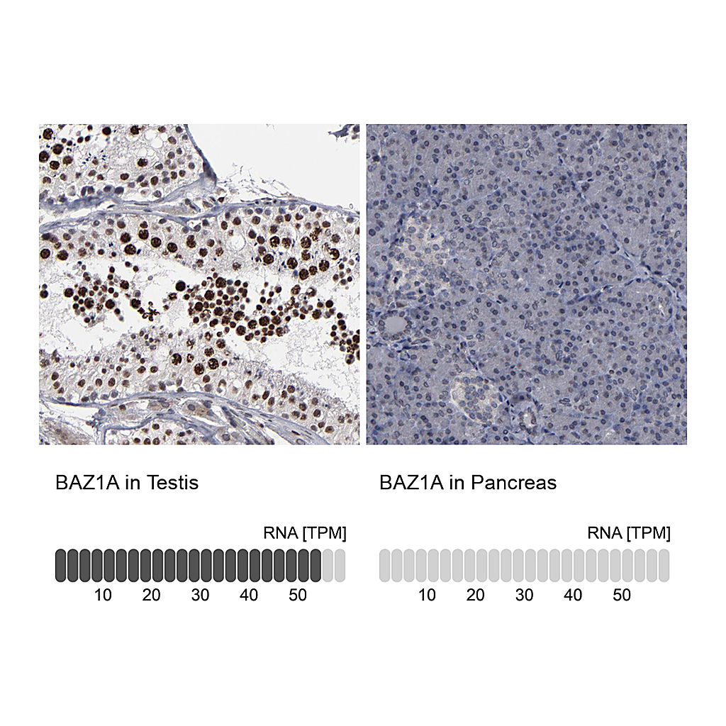 Atlas Antibodies Anti-BAZ1A Antibody