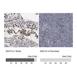 Atlas Antibodies Anti-BAZ1A Antibody