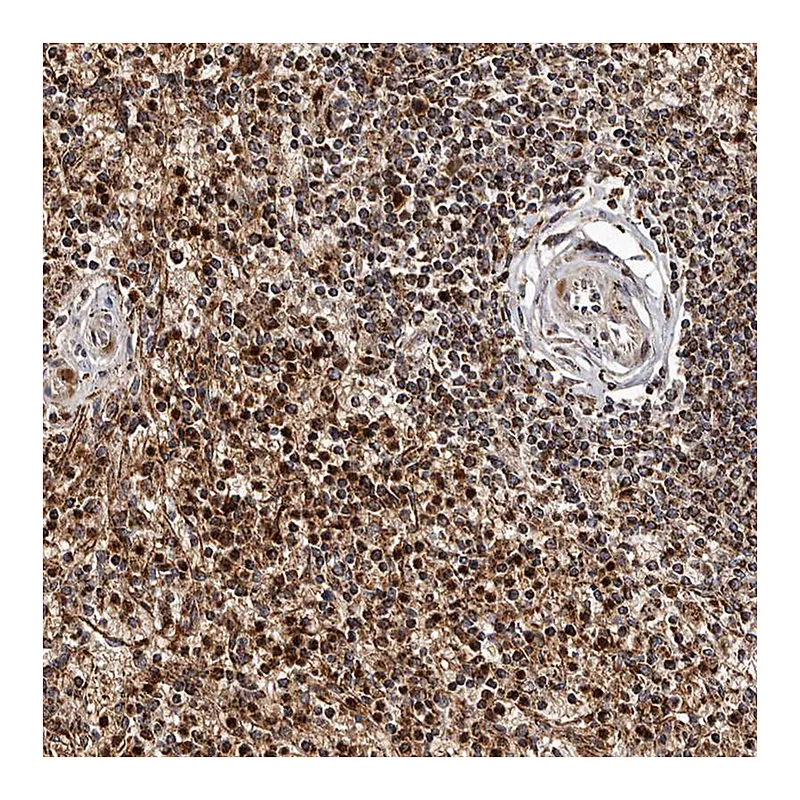 Atlas Antibodies Anti-BAX Antibody