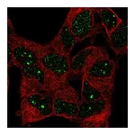 Atlas Antibodies Anti-BAZ1B Antibody