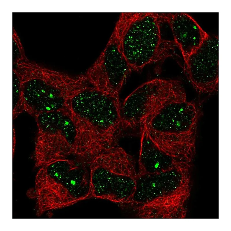 Atlas Antibodies Anti-BAZ1B Antibody