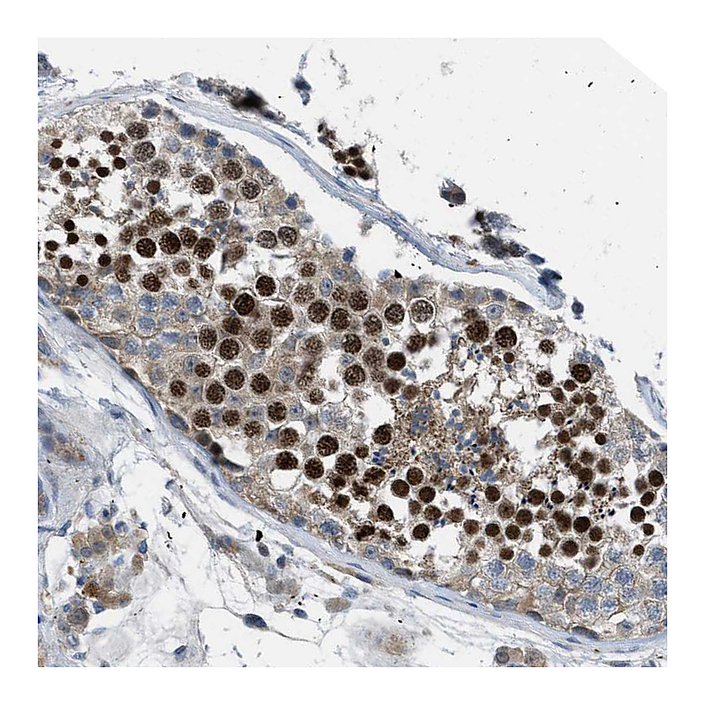 Atlas Antibodies Anti-BAZ2B Antibody