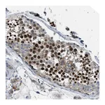 Atlas Antibodies Anti-BAZ2B Antibody