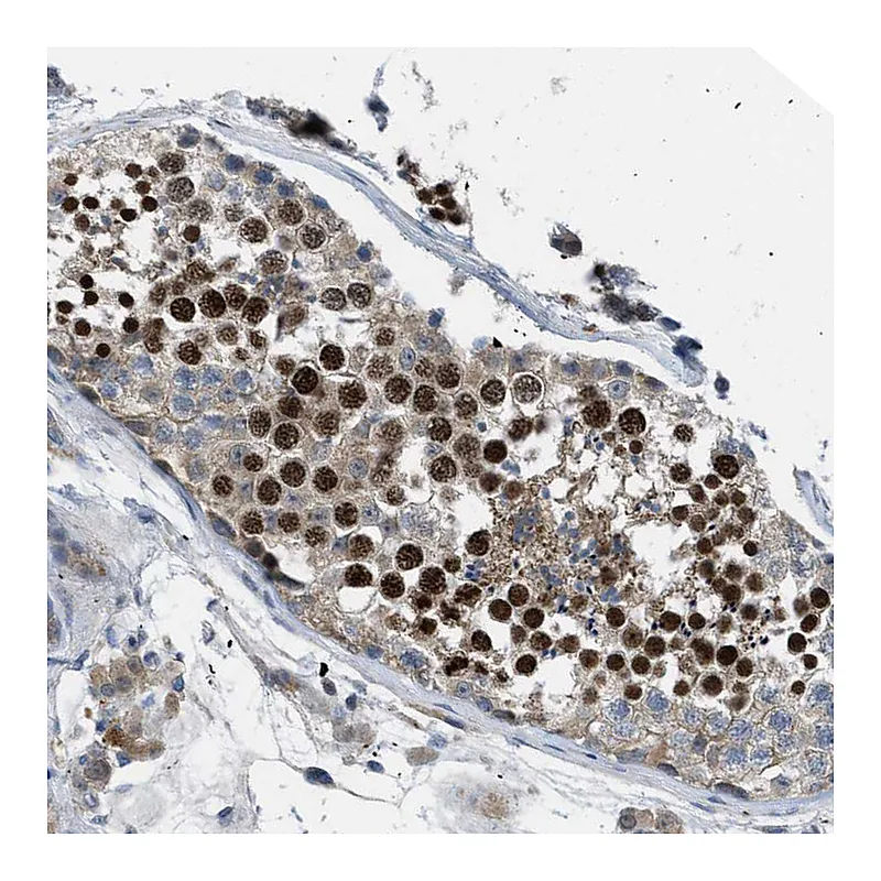 Atlas Antibodies Anti-BAZ2B Antibody