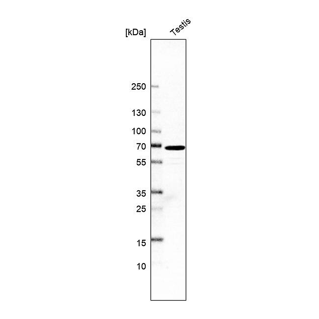 Atlas Antibodies Anti-BBOF1 Antibody
