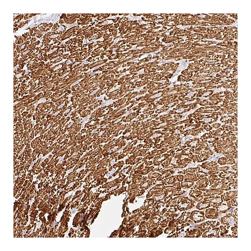 Atlas Antibodies Anti-BBIP1 Antibody