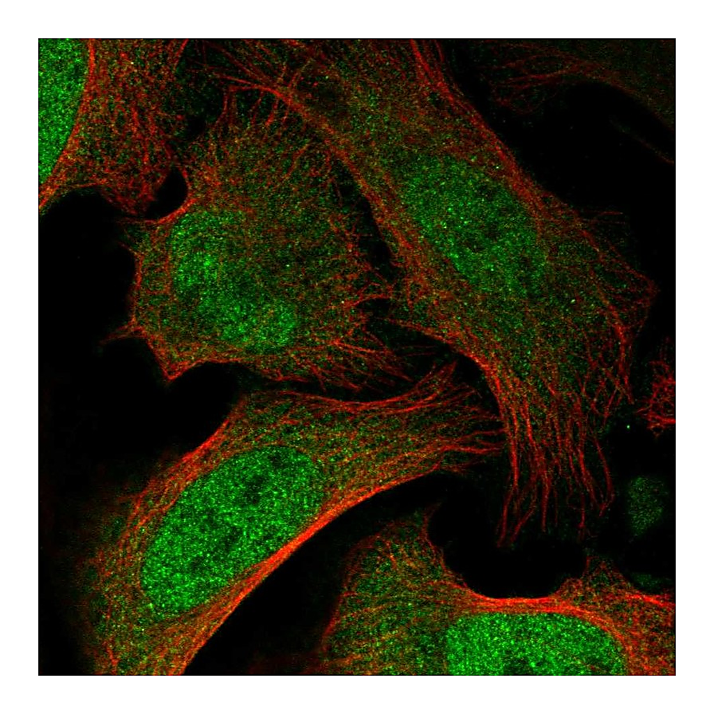 Atlas Antibodies Anti-BAZ2B Antibody