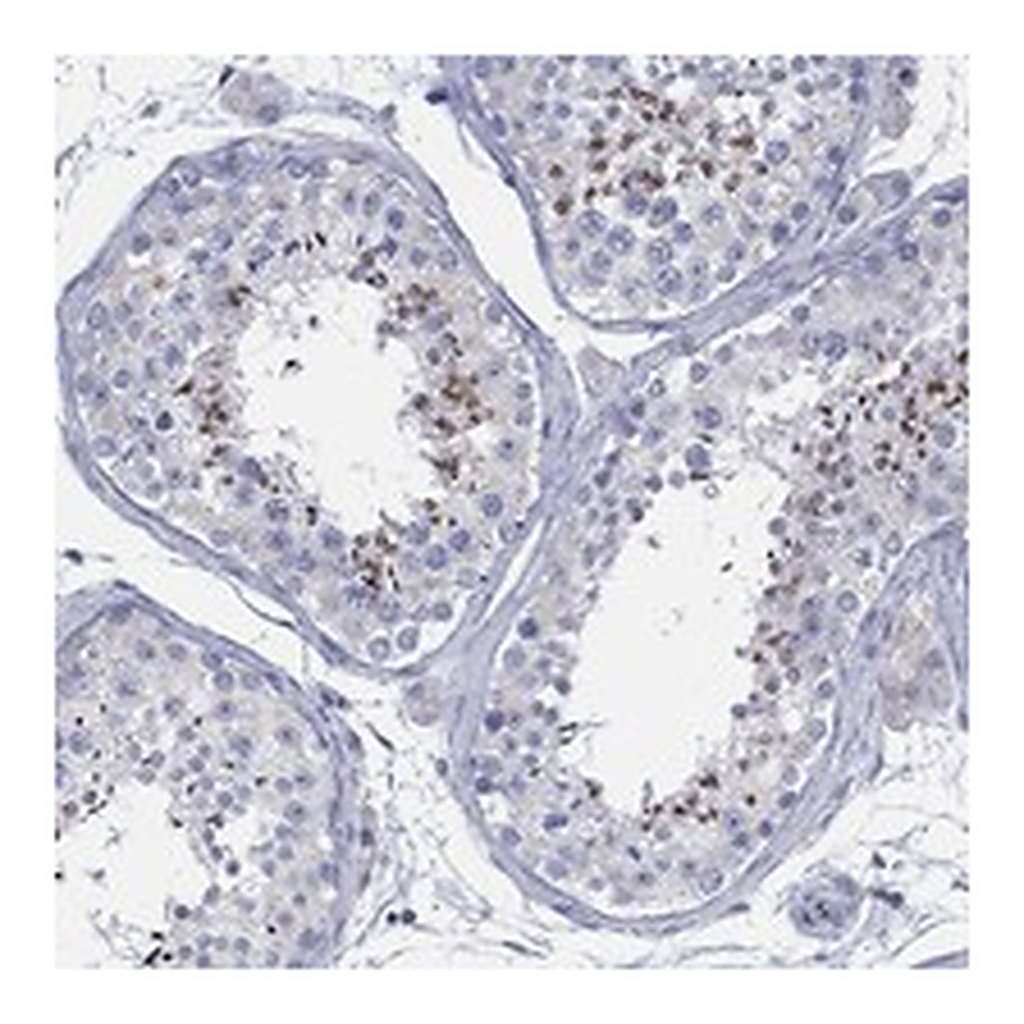 Atlas Antibodies Anti-BBOF1 Antibody