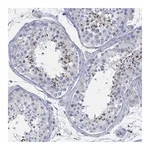 Atlas Antibodies Anti-BBOF1 Antibody