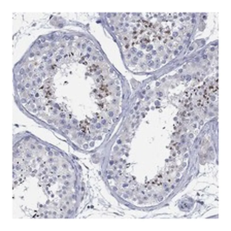 Atlas Antibodies Anti-BBOF1 Antibody