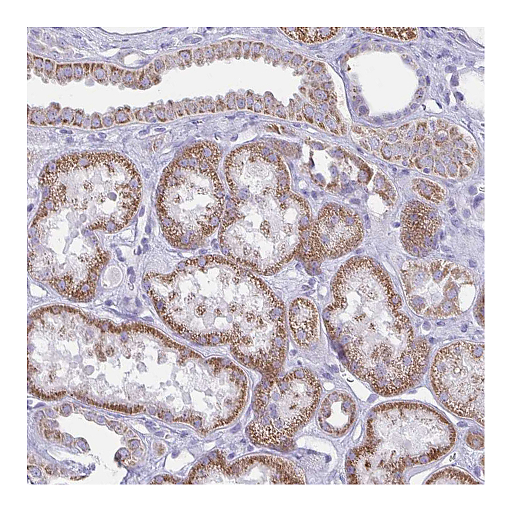 Atlas Antibodies Anti-BBS1 Antibody