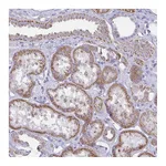 Atlas Antibodies Anti-BBS1 Antibody
