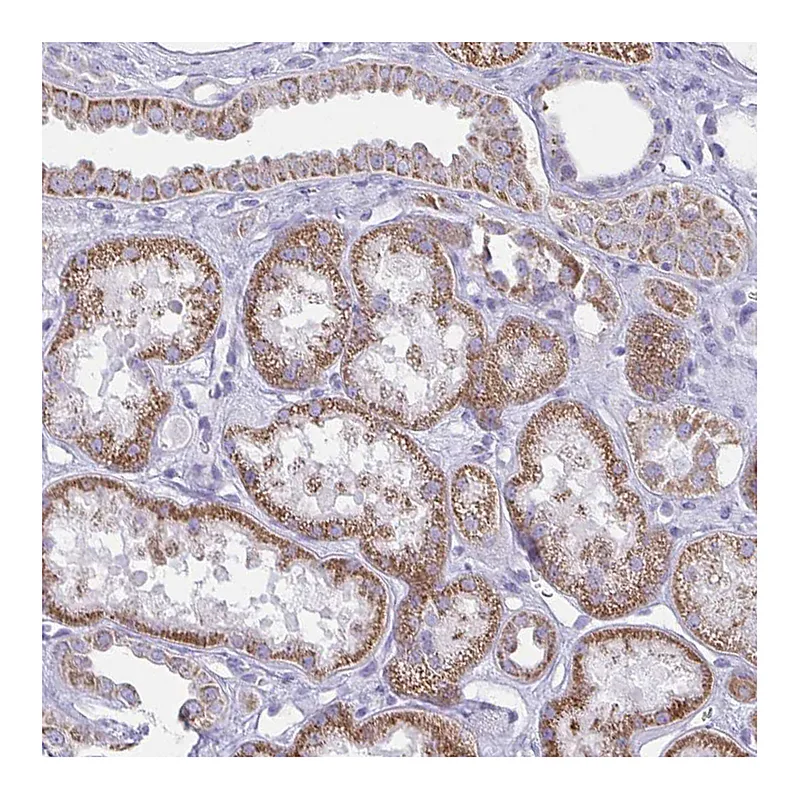 Atlas Antibodies Anti-BBS1 Antibody