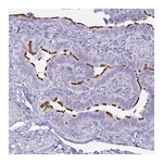 Atlas Antibodies Anti-BBS10 Antibody