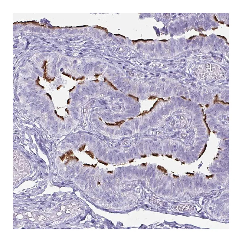 Atlas Antibodies Anti-BBS10 Antibody