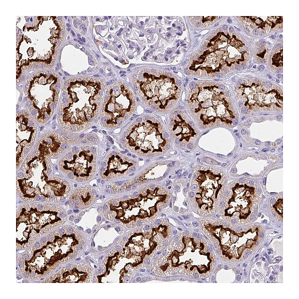 Atlas Antibodies Anti-BBS12 Antibody