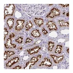 Atlas Antibodies Anti-BBS12 Antibody