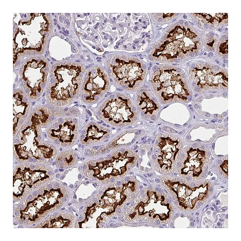 Atlas Antibodies Anti-BBS12 Antibody