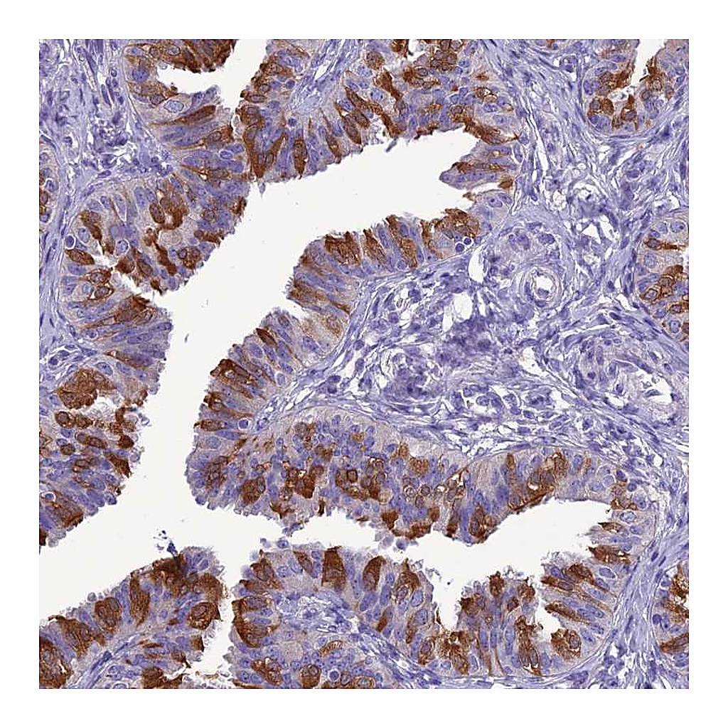 Atlas Antibodies Anti-BBS2 Antibody