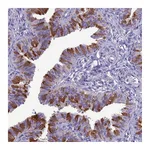 Atlas Antibodies Anti-BBS2 Antibody
