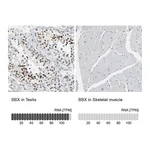 Atlas Antibodies Anti-BBX Antibody