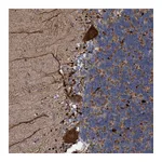 Atlas Antibodies Anti-BBS9 Antibody