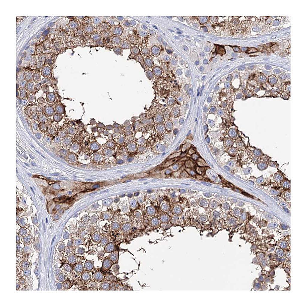 Atlas Antibodies Anti-BBS4 Antibody
