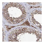 Atlas Antibodies Anti-BBS4 Antibody