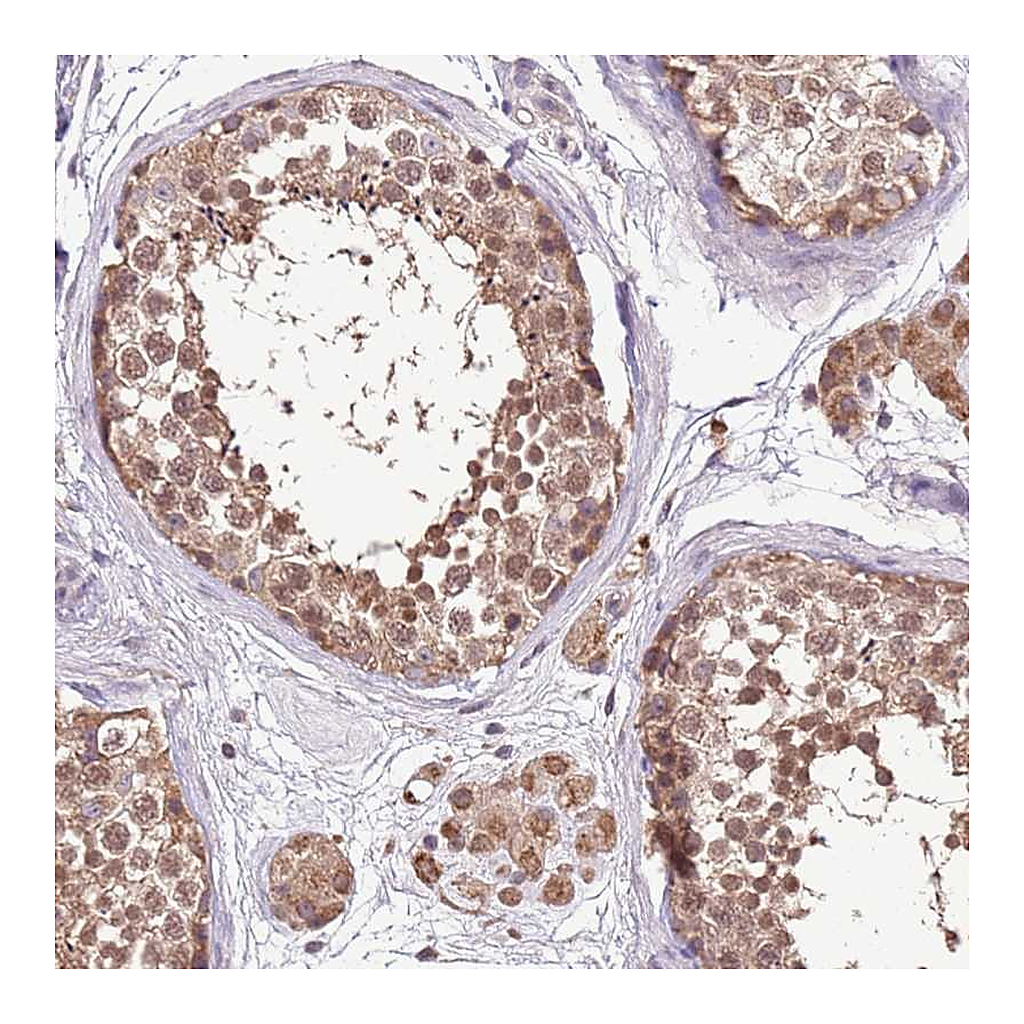 Atlas Antibodies Anti-BBS5 Antibody