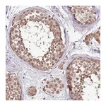 Atlas Antibodies Anti-BBS5 Antibody