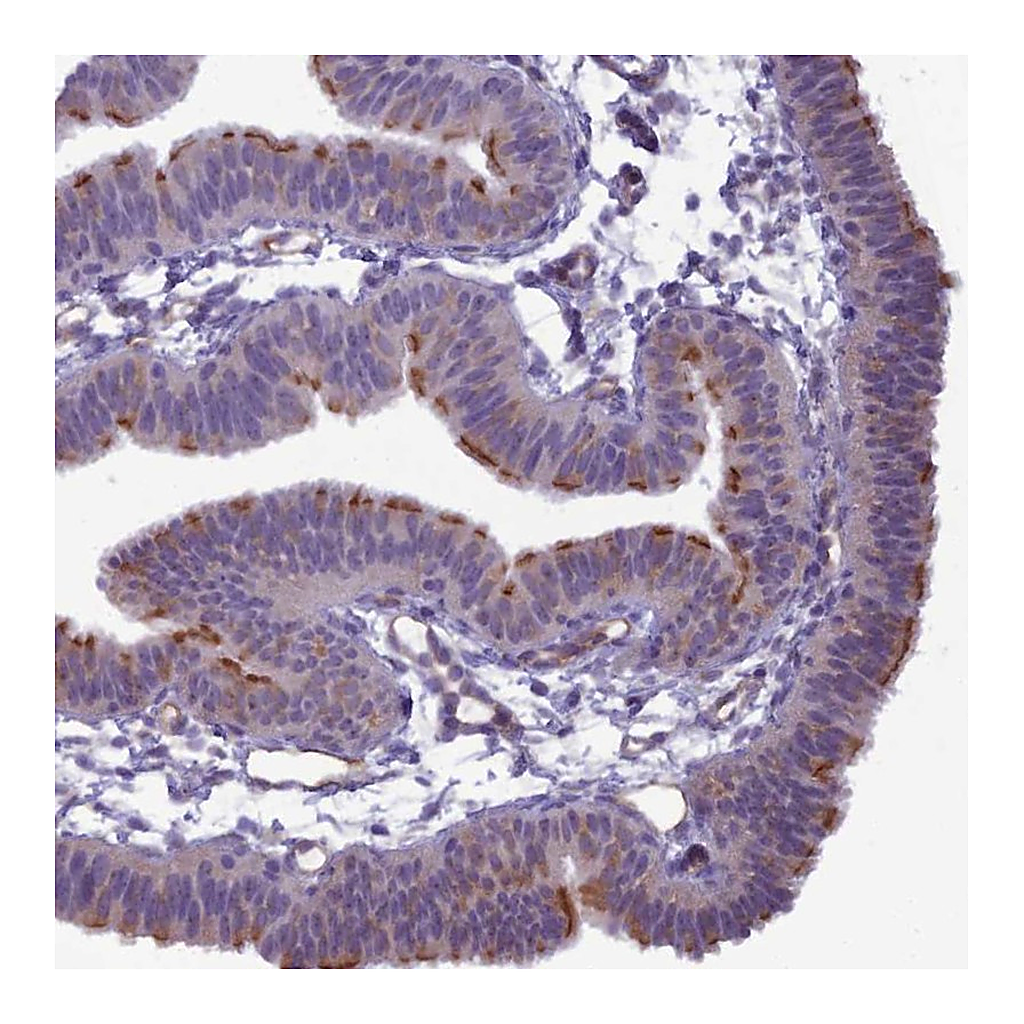 Atlas Antibodies Anti-BBS7 Antibody