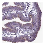 Atlas Antibodies Anti-BBS7 Antibody