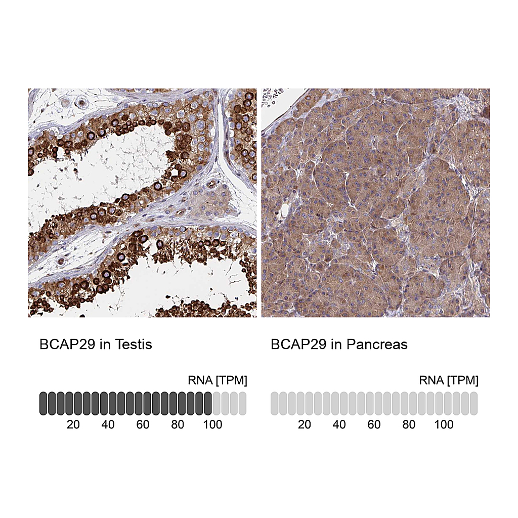 Atlas Antibodies Anti-BCAP29 Antibody