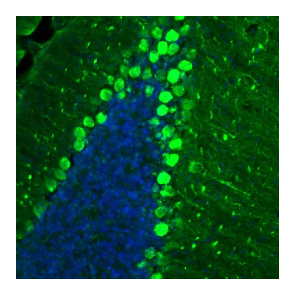 Atlas Antibodies Anti-BCAR1 Antibody