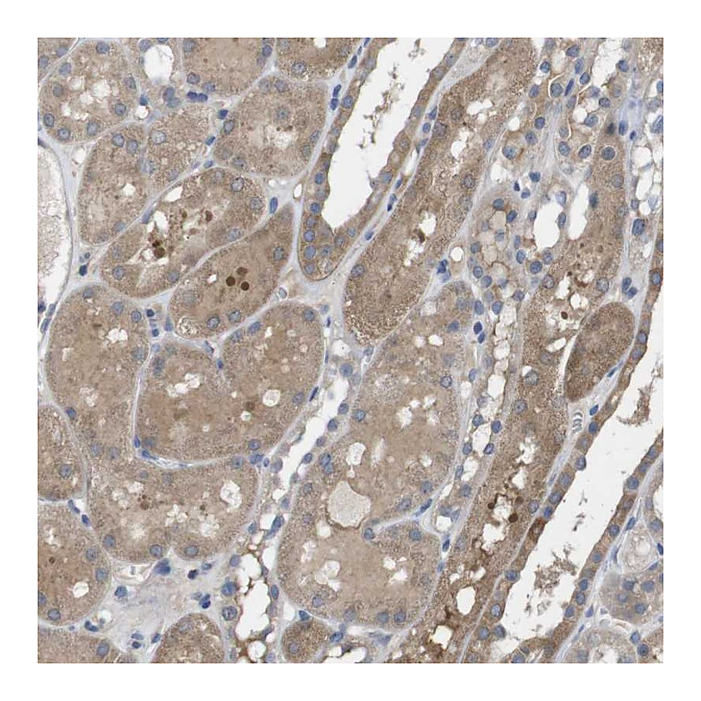 Atlas Antibodies Anti-BCAR3 Antibody