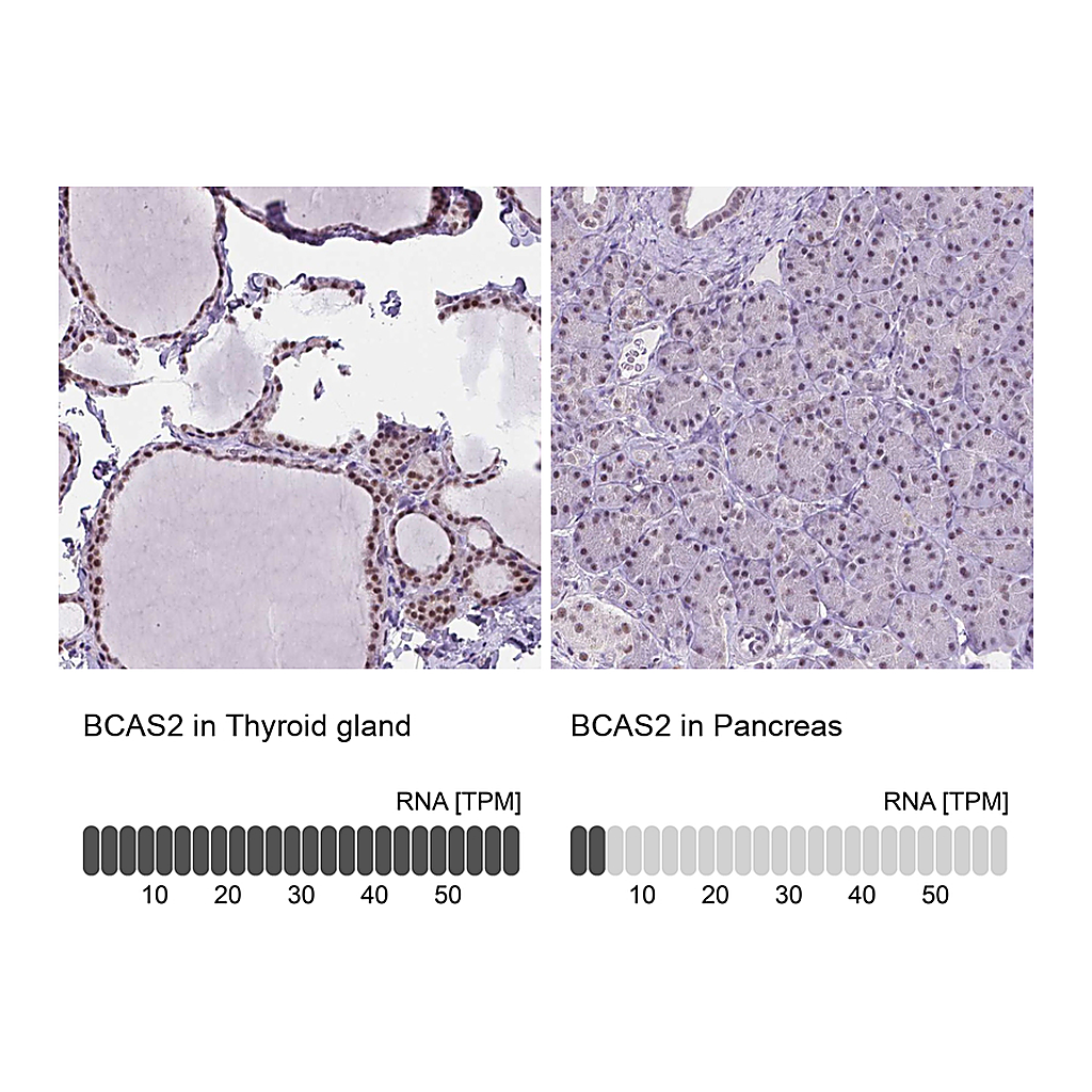 Atlas Antibodies Anti-BCAS2 Antibody