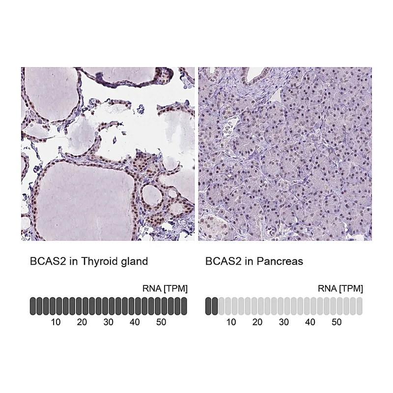 Atlas Antibodies Anti-BCAS2 Antibody