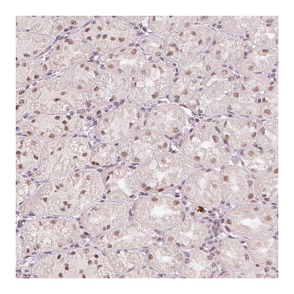 Atlas Antibodies Anti-BCAS3 Antibody