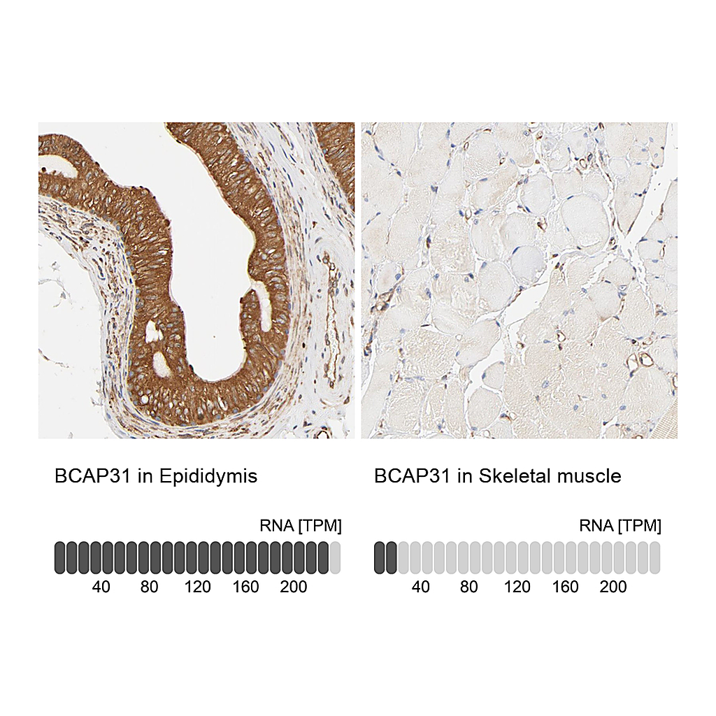 Atlas Antibodies Anti-BCAP31 Antibody