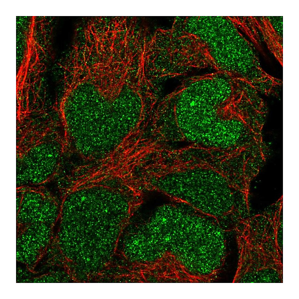 Atlas Antibodies Anti-BCCIP Antibody