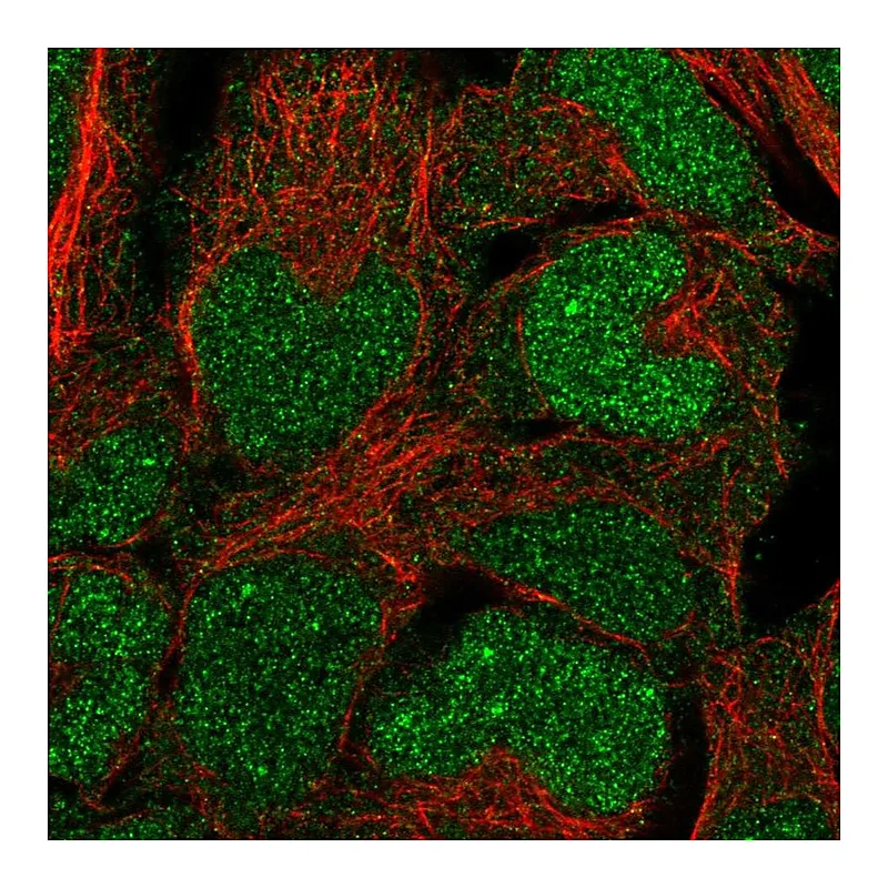 Atlas Antibodies Anti-BCCIP Antibody