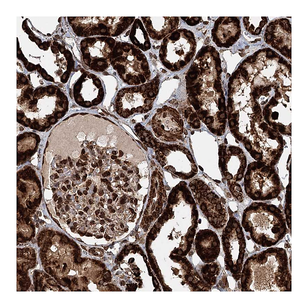 Atlas Antibodies Anti-BCKDHA Antibody