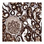 Atlas Antibodies Anti-BCKDHA Antibody