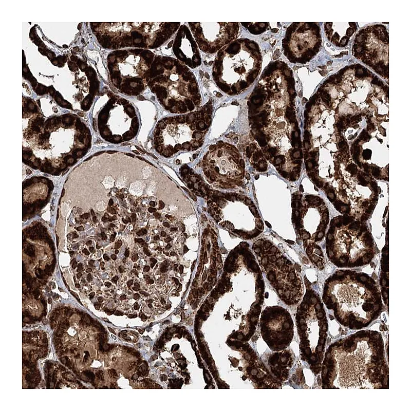 Atlas Antibodies Anti-BCKDHA Antibody