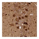 Atlas Antibodies Anti-BCDIN3D Antibody